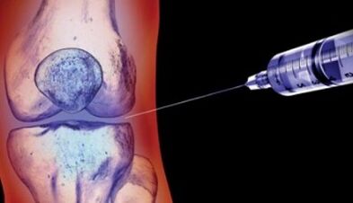 methods of treating joint osteoarthritis
